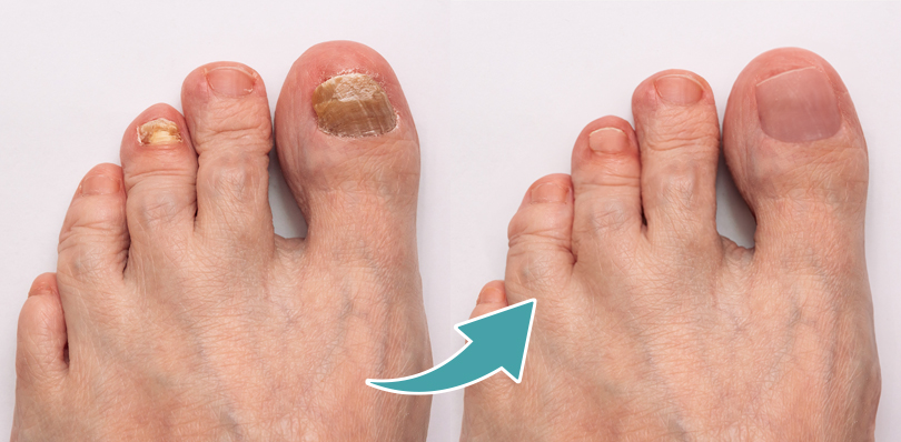 INFORMACJE DERMATOLOGICZNE