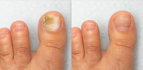 INFORMACJE DERMATOLOGICZNE