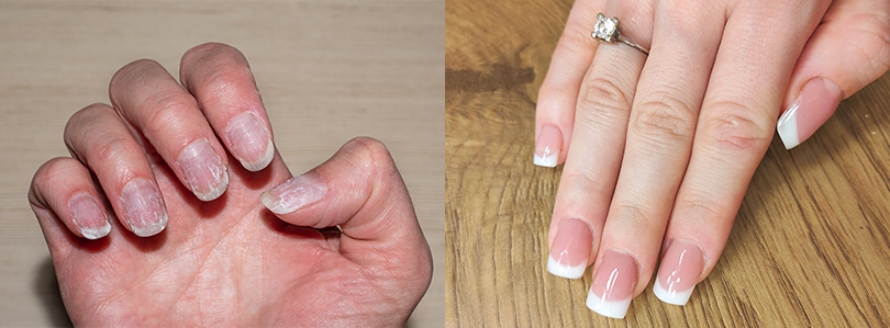 INFORMACJE DERMATOLOGICZNE